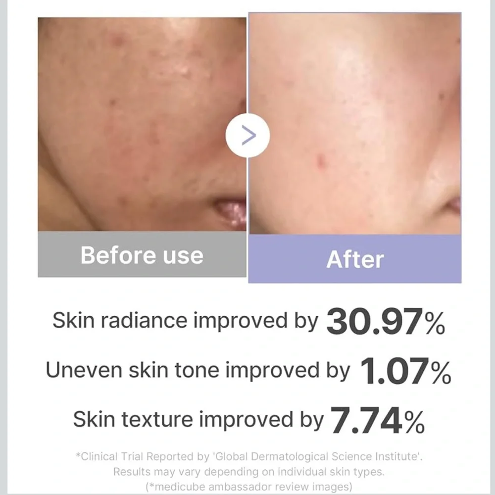 NIB sealed Medicube MiniBooster Pro,PortableGlow GlassSkin,KoreanSkinCare ORG$90 - Picture 4 of 7